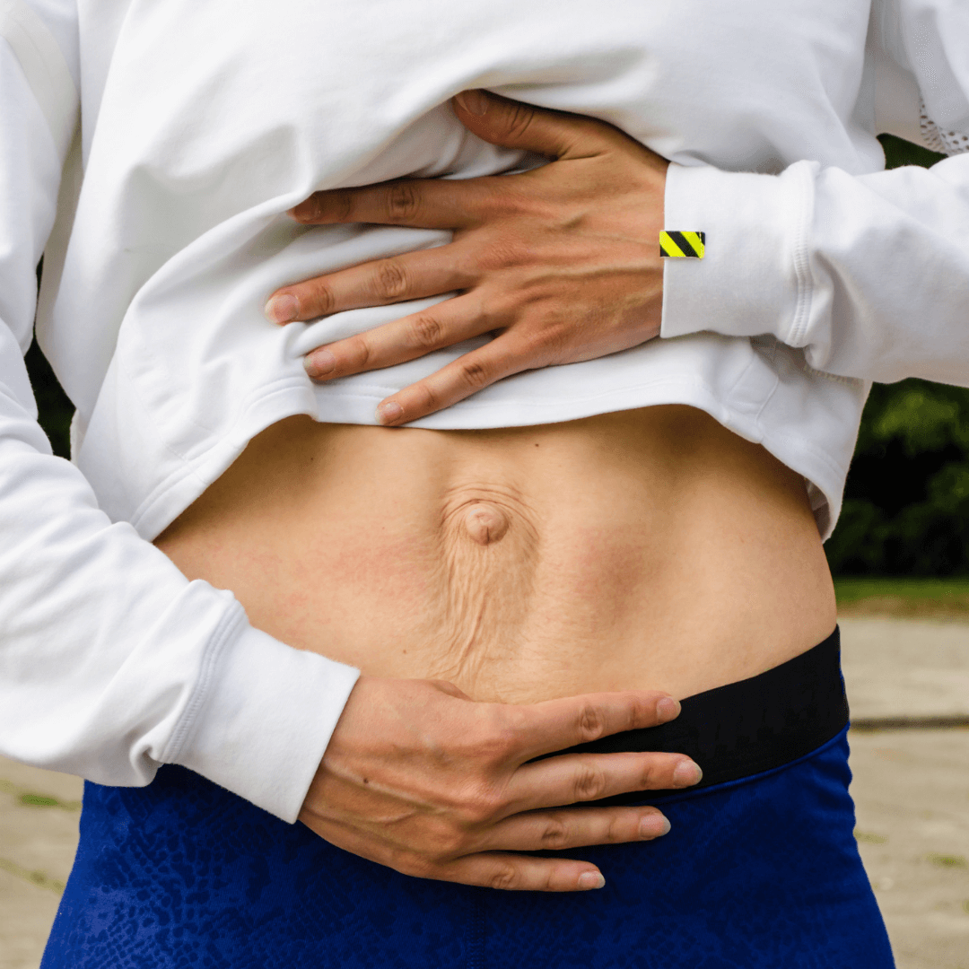 Abdominal Separation – What It Is and What You Can Do About It.
